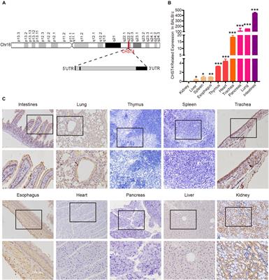 Carbohydrate Sulfotransferase 4 Inhibits the Progression of Hepatitis B Virus-Related Hepatocellular Carcinoma and Is a Potential Prognostic Marker in Several Tumors